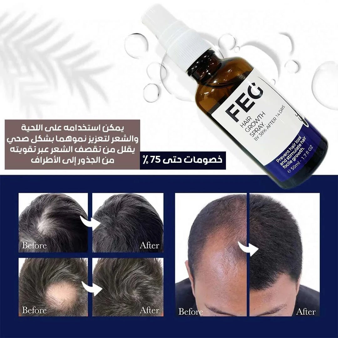 FEG Hair Growth Spray